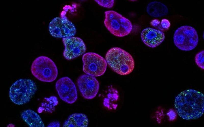 Photo credit: National Cancer Institute