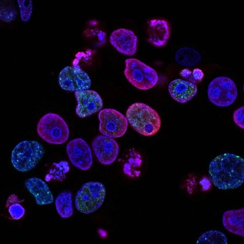 Photo credit: National Cancer Institute