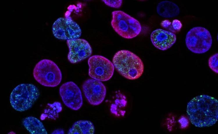 Photo credit: National Cancer Institute